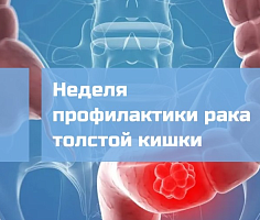  С 7 по 13 ноября Минздрав Российской Федерации проводит Неделю профилактики рака толстой кишки.